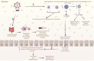 HIV, opioid use, and alterations to the gut microbiome: elucidating independent and synergistic effects